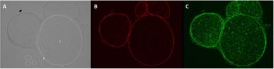 Quantitative and Microstructural Changes of the Blood-Nerve Barrier in Peripheral Neuropathy